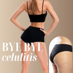 Bye Bye Celulitis