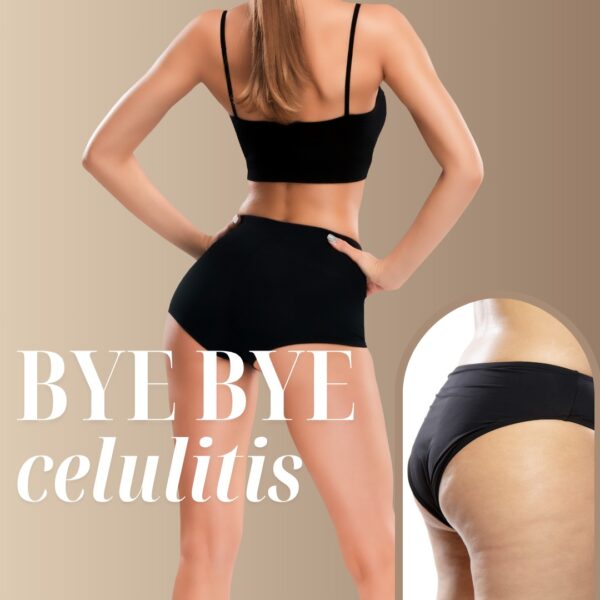 Bye Bye Celulitis