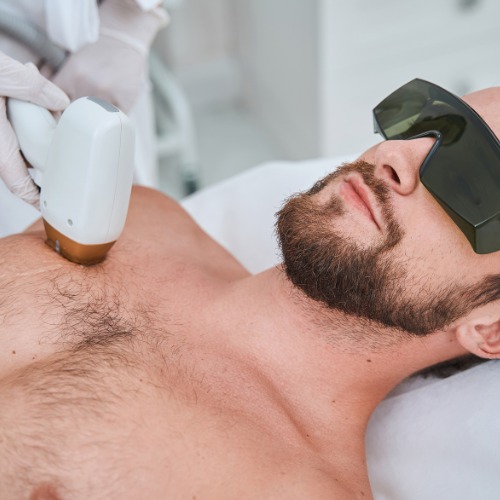 Depilación láser masculina en Medellín