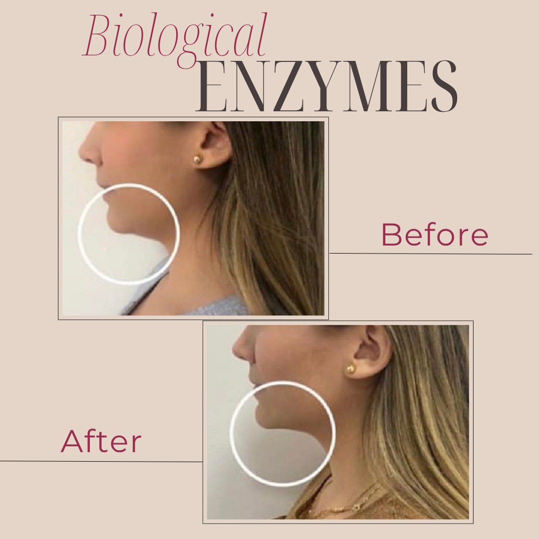 Biological Enzyme Treatment Results
