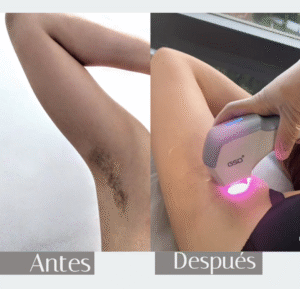 antes y después